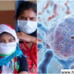 Chandipura virus